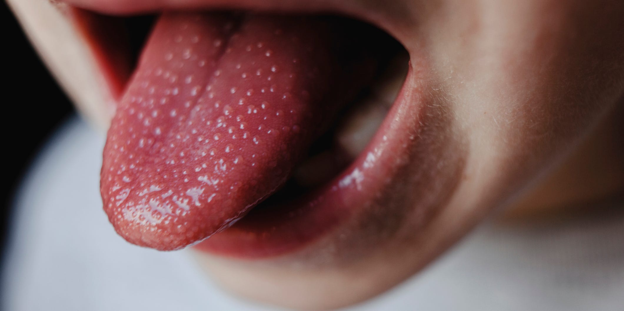 Langue avec petites inflammations