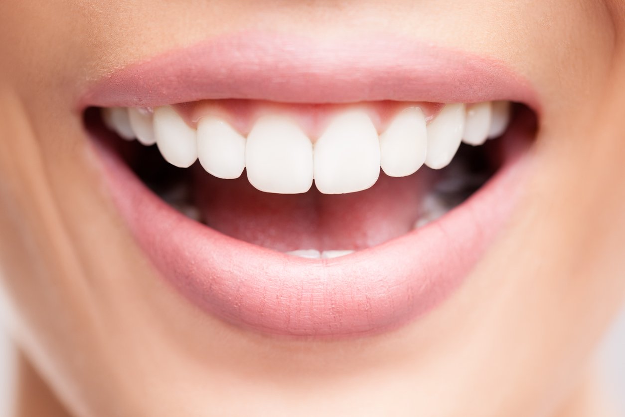 Différence entre dents ternes et dents blanches