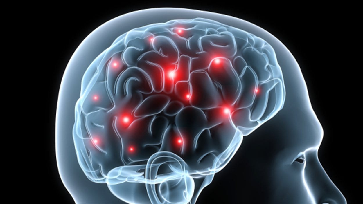 Cerveau en activité lors d'un test visuel