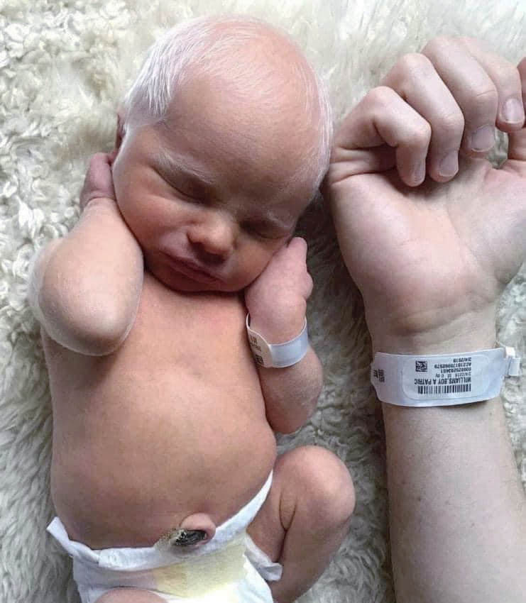 Enfant albinos aux yeux bleus hypnotiques