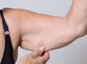 Illustration représentant la perte musculaire liée à l'âge