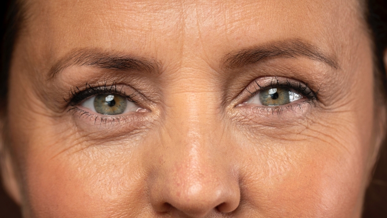 Ridules et signes de l'âge sur le visage