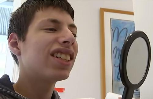 Evan après son traitement, avec un sourire radieux