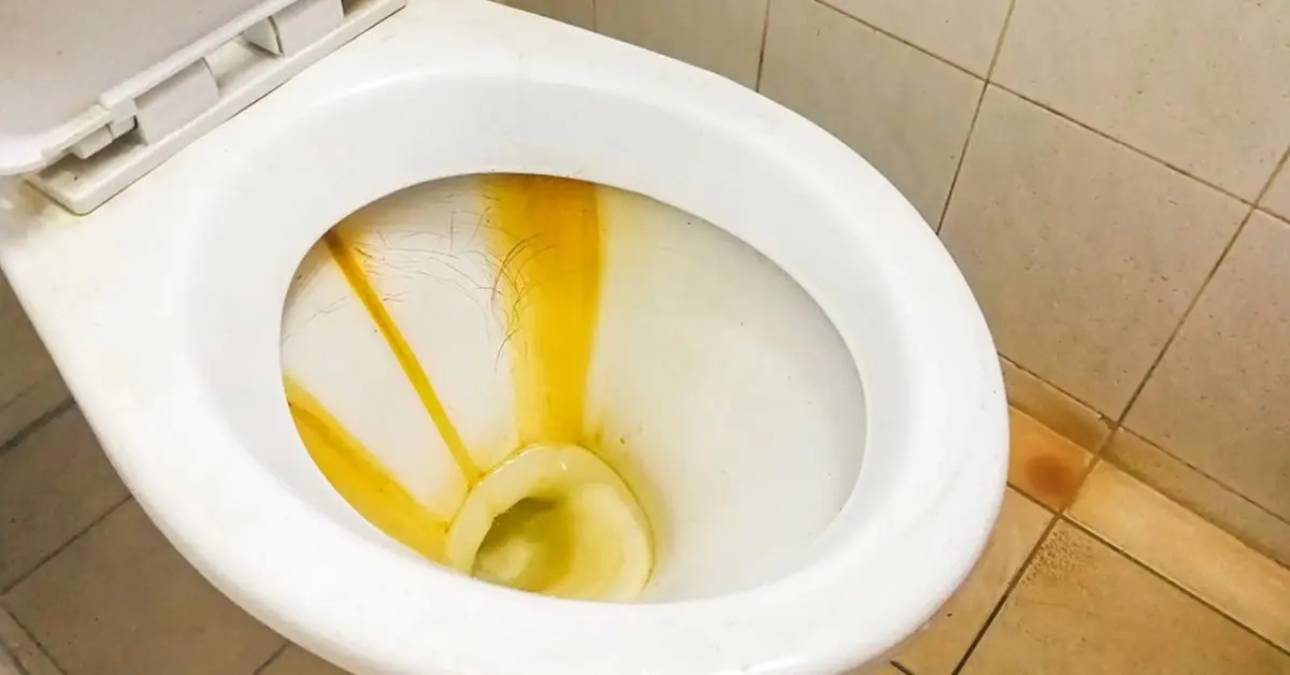 Nettoyage naturel des toilettes - astuce contre le calcaire